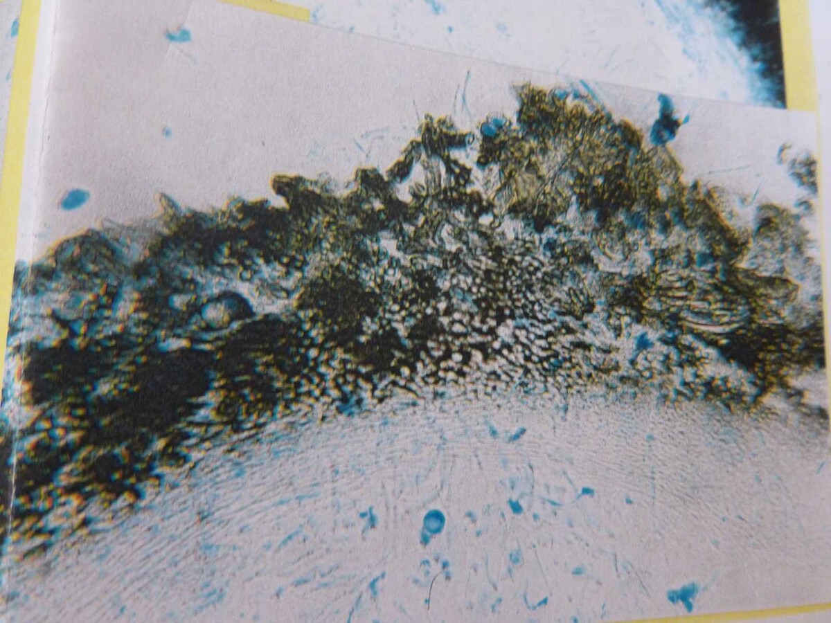 Fenestella phaeospora image