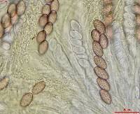 Ascobolus lineolatus image