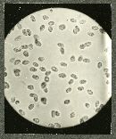 Pseudoarmillariella ectypoides image