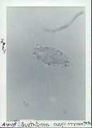 Scutellinia asperrima image