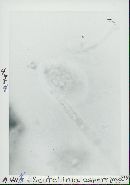 Scutellinia asperrima image