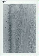 Floccularia luteovirens f. luteovirens image