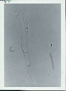 Floccularia luteovirens f. luteovirens image