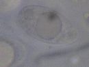 Trapelia coarctata image