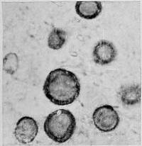 Tulostoma macrosporum image