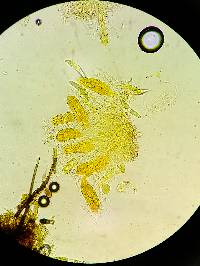 Thaxteriella pezizula image