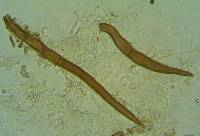 Trichophaea hybrida image