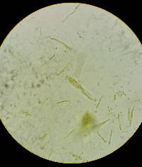 Pachycudonia spathulata image