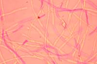Mitrula elegans image