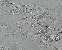 Scutellinia crinita image