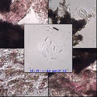 Arthopyrenia punctiformis image