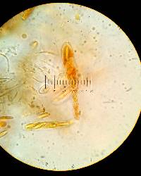 Myriophacidium aphyophyllicum image