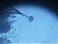 Dematioscypha dematiicola image
