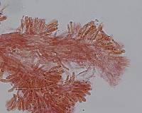 Stromatoscypha fimbriata image