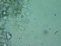 Acanthobasidium penicillatum image