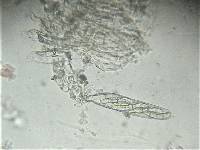Sporormiella teretispora image