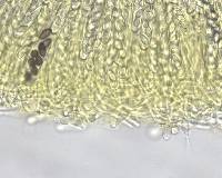 Ascobolus crenulatus image