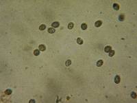 Melanoleuca stridula image