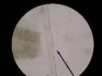 Tolypocladium longisegmentatum image