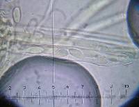 Dumontinia tuberosa image