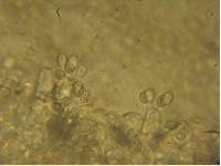 Melanoleuca stridula image