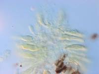 Mycosphaerella cunninghamii image