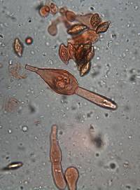 Austroboletus lacunosus image