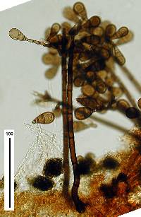Image of Brachysporiella pulchra