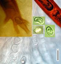 Scutellinia badio-berbis image