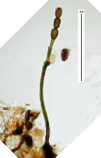 Image of Catenularia longispora