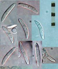 Ascocoryne sarcoides image