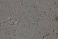 Cystodermella granulosa image