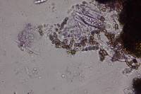 Colletotrichum coccodes image