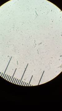Dicephalospora rufocornea image