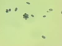 Rhizopogon atroviolaceus image