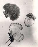 Scutellinia setosa image